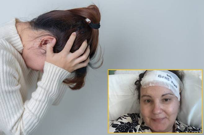 두통을 불안 탓으로 여겨 온 30대 여성이 수년 뒤 귤 크기의 뇌종양을 진단받은 사연이 전해졌다. 배경사진=게티이미지뱅크/하단=SNS