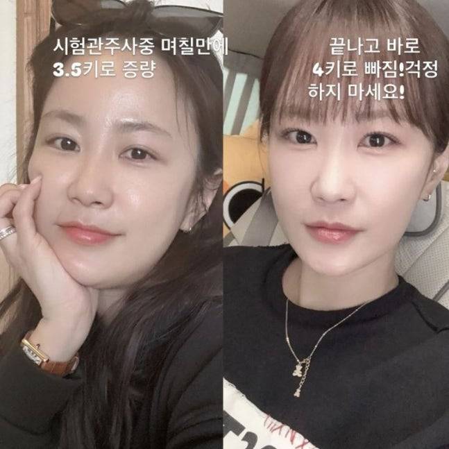 김지민이 시술관 시술 후 달라진 모습을 공개했다. 사진=김지민 인스타그램
