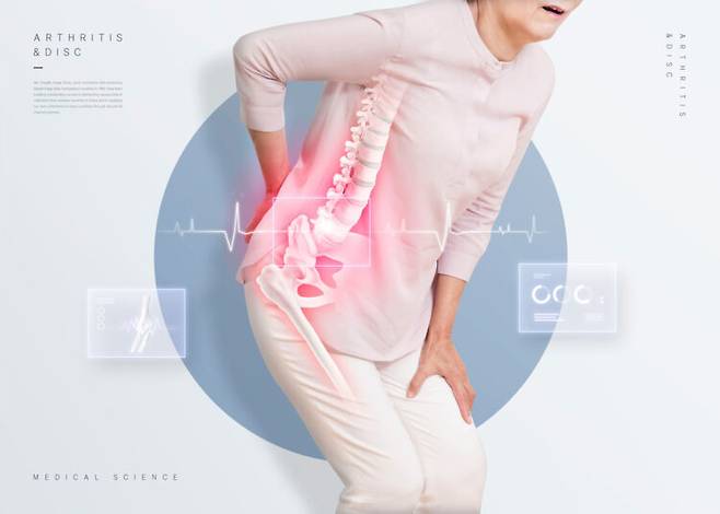 척추전방전위증은 척추 어디에서든 생길 수 있다. 하지만 허리에서 더 흔하다. 사진=클립아트코리아