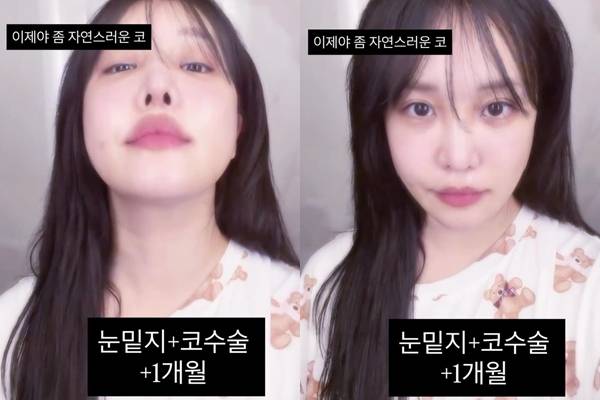 ⓒ랄랄 SNS 캡처