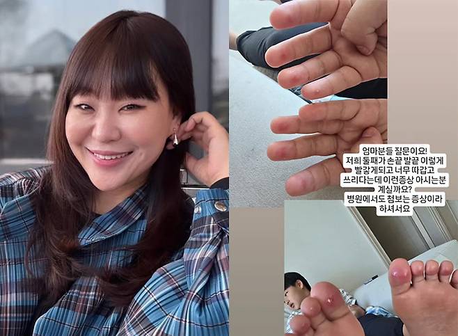 개그우먼 정주리가 둘째 아들의 증상을 공개하며 도움을 청했다. /사진=정주리 인스타그램