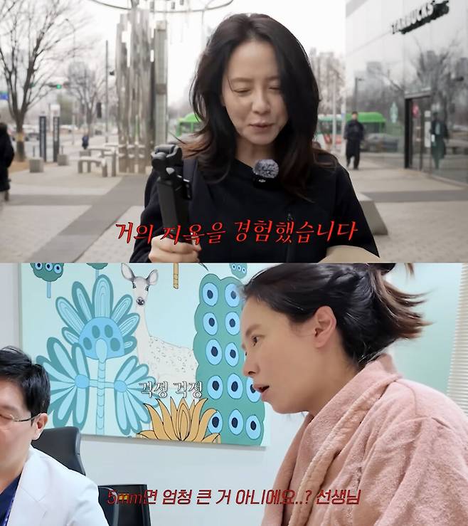 송지효는 생애 첫 건강검진에서 약 5㎜ 크기의 대장 용종을 발견해 검사 중 제거했다. 유튜브 채널 ‘송지효 JIHYO SSONG’ 캡처