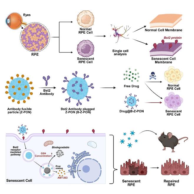 노화된 망막색소상피세포만을 타켓으로 셀놀리틱 약물을 전달하는 나노 입자. 연구그림=UNIST