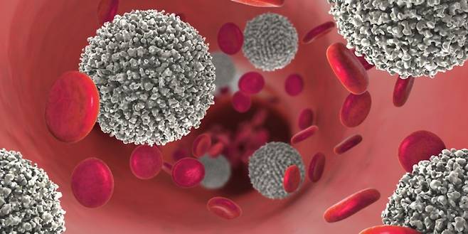 비정상적인 백혈구(흰색)가 과도하게 증식하면 백혈병이 된다. 게티이미지뱅크 제공.