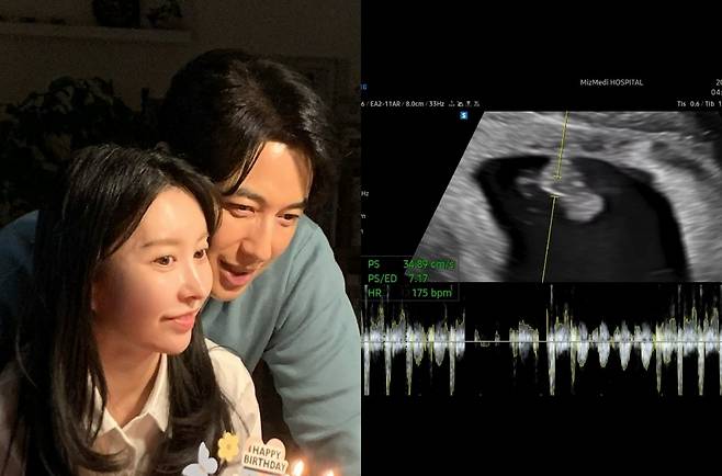 /사진=아야네 SNS