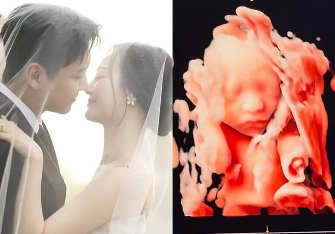 ▲ 그룹 FT아일랜드 출신 배우 송승현이 아빠가 된다. 출처|송승현 인스타그램