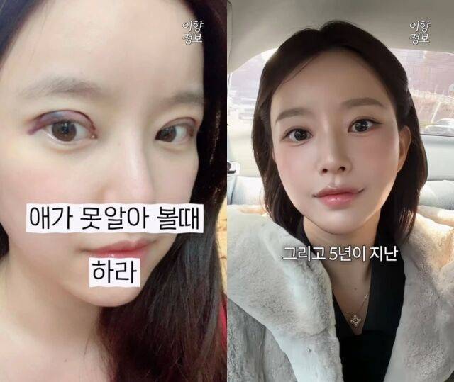/ 이향 인스타그램