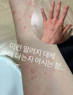 그룹 시크릿 출신 전효성이 고양이 알레르기가 생겼다고 밝혔다. [사진출처 = 인스타그램]