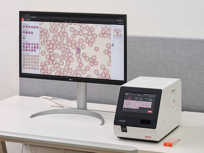노을 AI 기반 말라리아 솔루션(miLab MAL). [노을 제공]