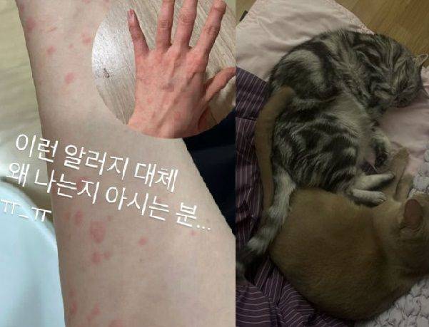 전효성이 손등까지 퍼진 두드러기의 원인이 '고양이털알레르기'였다고 밝혔다. 출처=전효성SNS