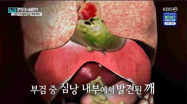 셀럽병사의 비밀