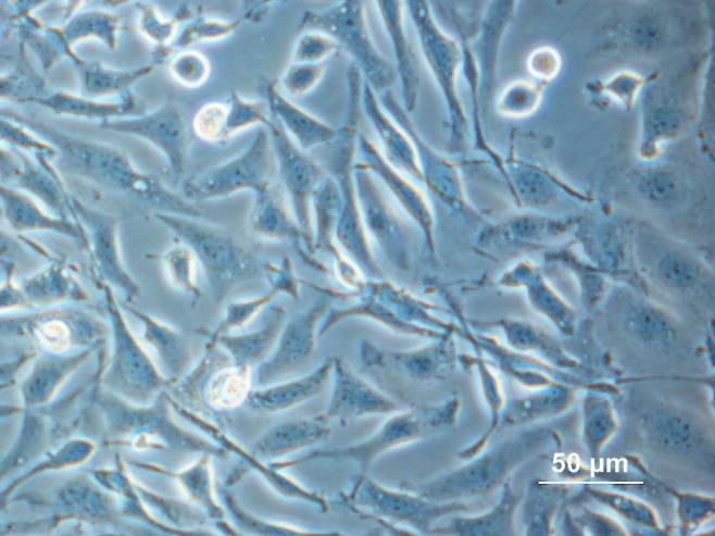 중국햄스터 난소세포(CHO Cell)를 현미경으로 확대한 사진. 위키미디어 제공