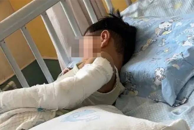 배달 간 엄마가 오는지 보려다 아파트 11층에서 추락한 4살 소년이 기적적으로 목숨을 건졌다./사진=소후