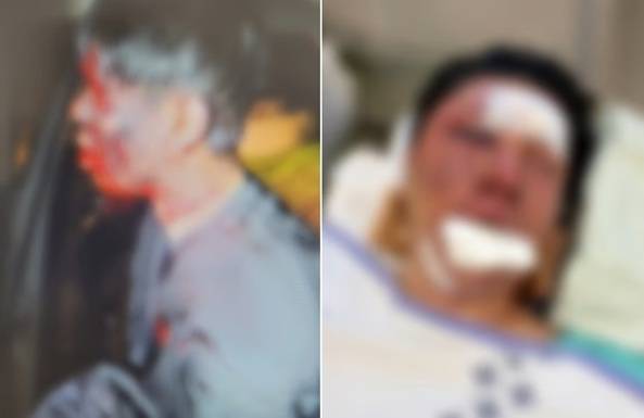 인터넷 방송인 수탉(본명 고진호)이 생방송에서 직접 공개한 납치·폭행 사건 구조 당시 모습. /사진=수탉 SOOP 방송국 갈무리