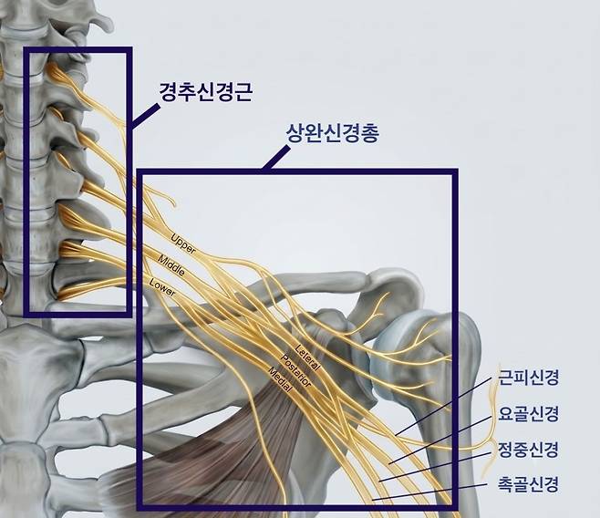 상완신경총 | 출처: Gemini 생성