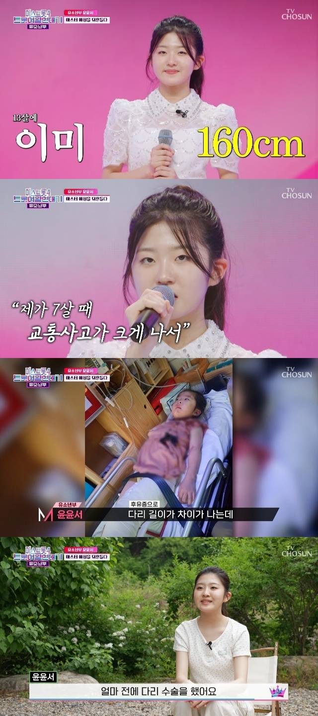 Trot singer Yoon Yoon-seo, currently a freshman in middle school, recently underwent leg surgery.On the fifth episode of TV Chosuns Mistrot 4 Trot Queen Chronicles, which aired on June 2, Yoon Yoon-seos latest news was revealed.Yoon Yoon-seo, who competed in the youth division of the survival program Mistrot 4, was in the sixth grade at the time and stunned the judges with her 160-centimeter height.She also drew attention for her unique story. When I was 7 years old, I had a big car accident and was hospitalized in the hospital for two months, and (as a result) my leg length is about 1-2 centimeters different. They told me that I will have to continue to undergo treatment to adjust my leg length until my growth stops, she said.Yoon Yoon-seo, who appeared on the show, said, I had leg surgery not long ago. Two months ago, I had leg surgery to close my growth plate. Im recovering hard right now, so I can dance and run well, she said.Meanwhile, Yoon Yoon Seo was born in 2013 and is 12 years old. She finished sixth in the final round of Mistrot 4.