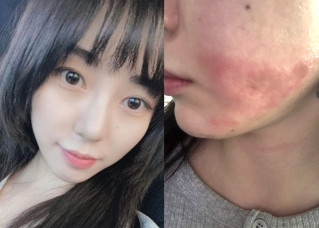 그룹 AOA 출신 권민아. 사진제공|권민아 SNS