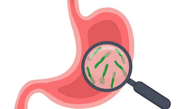 세계보건기구는 헬리코박터균을 1급 발암물질로 분류하고 있으며, 감염 시 위암 발생 위험이 2~3배 이상 높아지는 것으로 알려져 있다 | 출처: 클립아트코리아