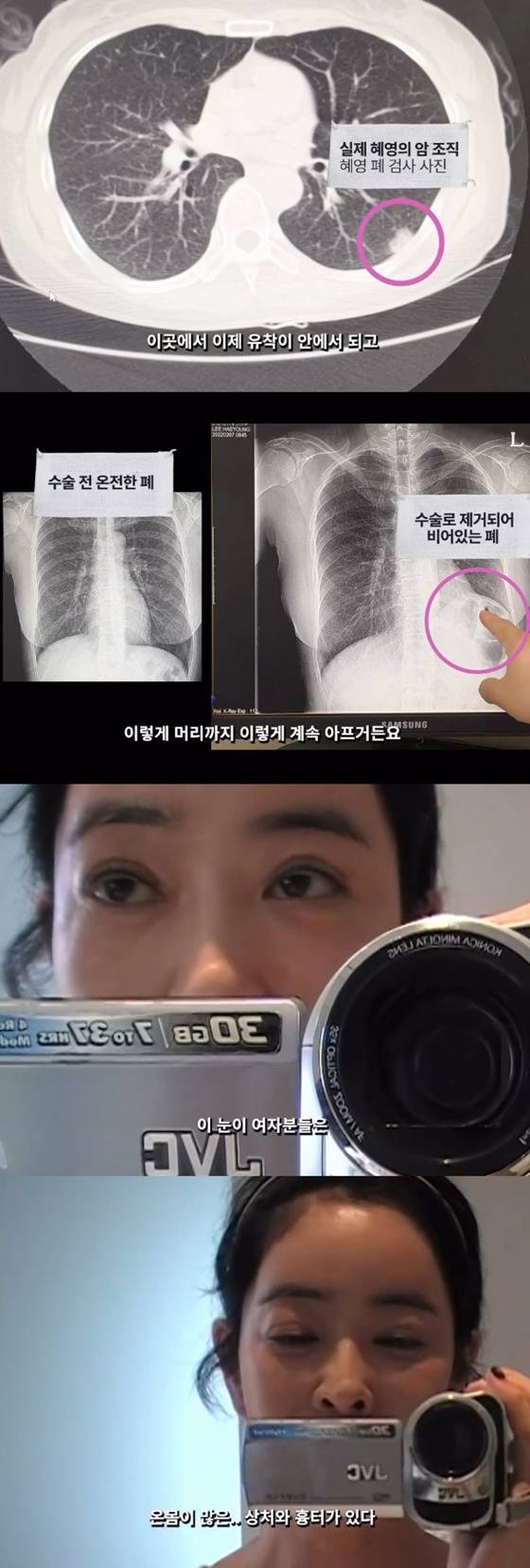 /사진=이혜영 SNS