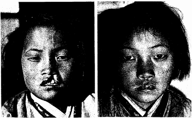 당시 발표된 슬라이드. 사진=Cleft Craft
