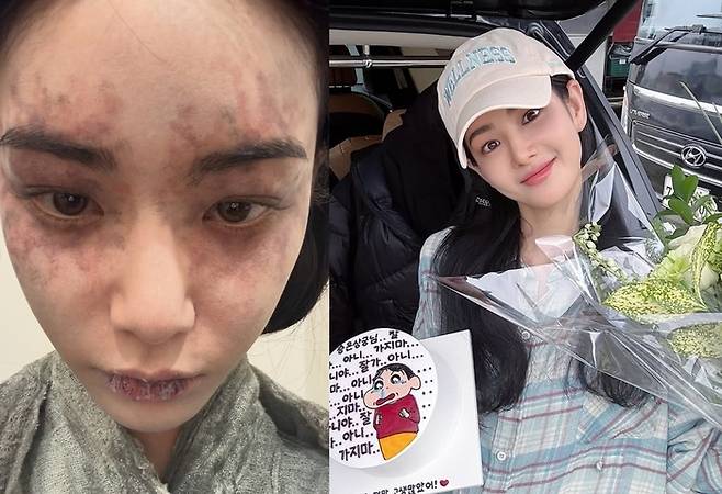 홍수주. 사진|홍수주 인스타그램