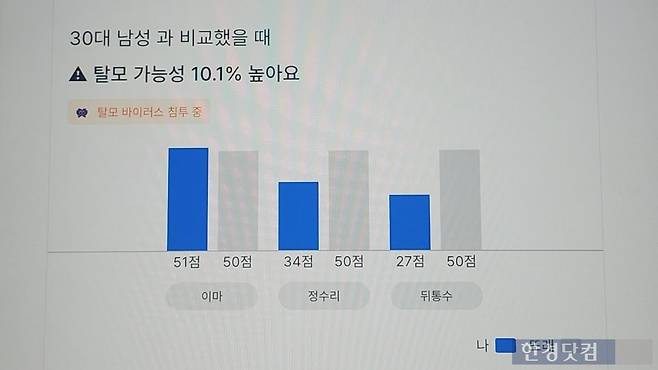 탈모는 많은 남성들의 고민거리다. 기자도 예외는 아니었다. 사진=오세성 기자