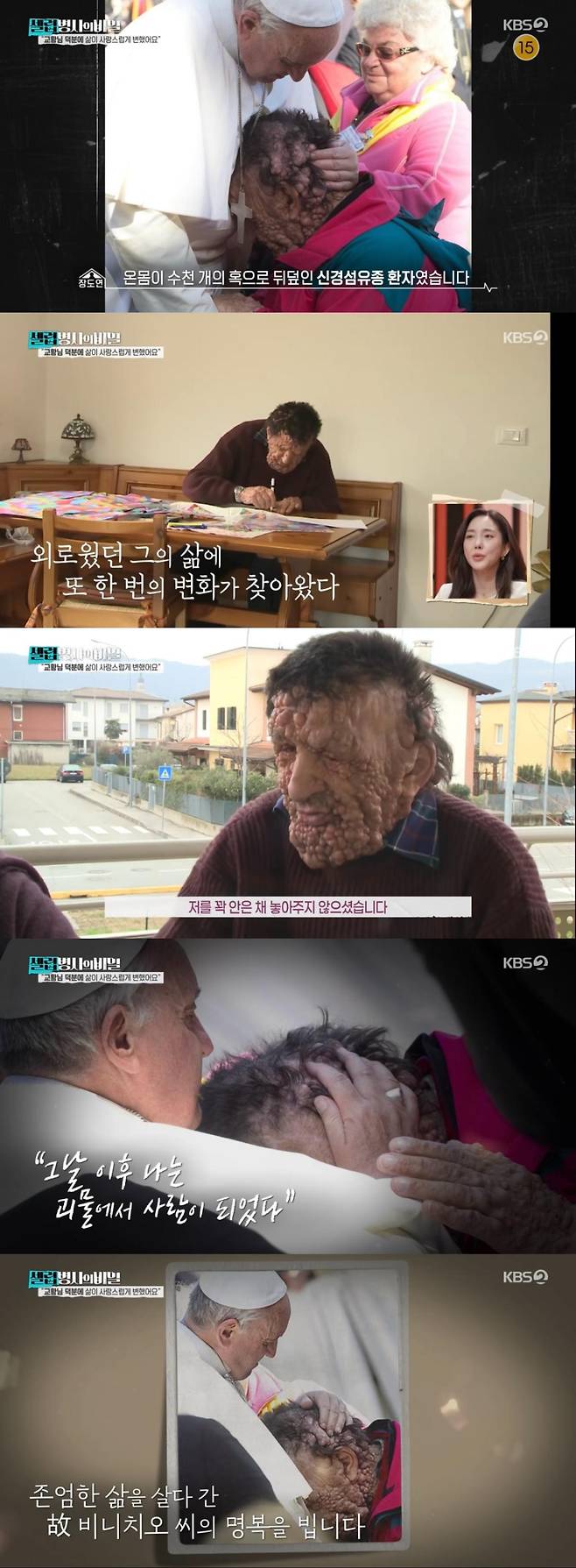 셀럽병사의 비밀 비니치오