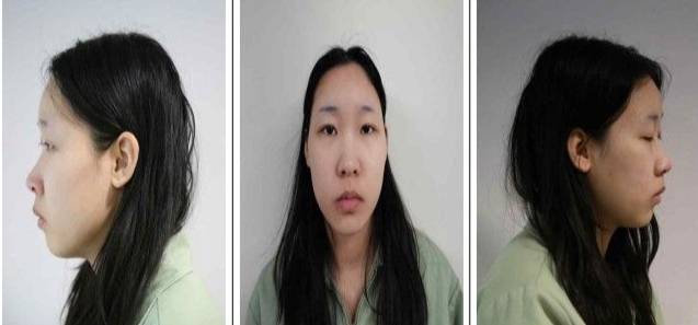 사진은 '강북구 모텔 연쇄 살인' 피고인 김소영(20)./사진제공=서울북부지검.