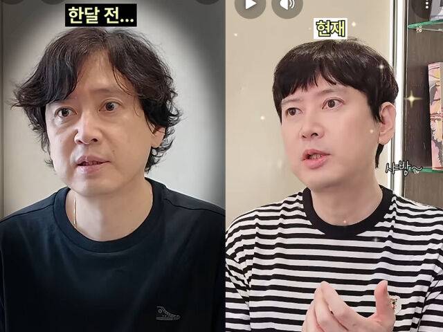 김진이 성형외과에서 시술을 받았다. / 유튜브 '청담 닥터원'