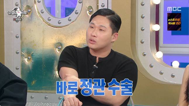 스윙스 정관수술 복원 라디오스타