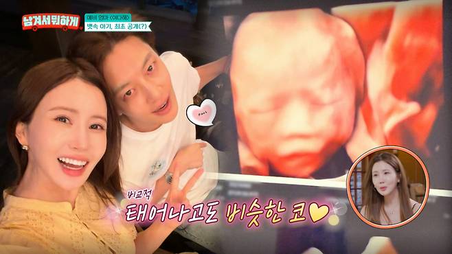 이다해가 아기 초음파 사진을 공개했다. /사진=tvN '남겨서 뭐하게' 캡처