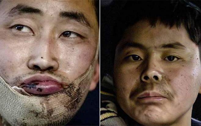 우크라이나군이 러시아 쿠르스크에서 생포한 북한군. 볼로디미르 젤렌스키 우크라이나 대통령 텔레그램 캡처