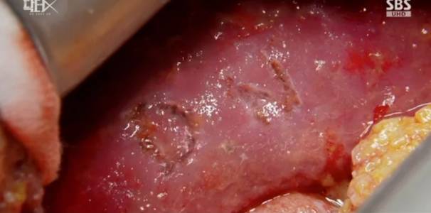 지난 17일 방송된 SBS 금토드라마 '닥터X: 하얀 마피아의 시대' 4회에서는 신임 외과 교수 나대일(장승조 분) 비밀을 파헤치는 계수정(김지원 분) 모습이 그려졌다. /사진=SBS 드라마 닥터X 갈무리