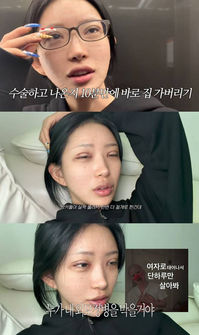 Choi Jun-hee, the daughter of the late actress Choi Jin-sil, has shared her experience with double eyelid revision surgery.On the 20th, a video titled The Incision Double Eyelid Surgery VLOG You All Waited For the Most, Review (And Instagram Suspension...) was posted on Choi Jun-hees YouTube channel.In the video, Choi Jun-hee announced that she had completed the surgery, stating, I did it. Eye shape correction, upper epicanthoplasty, and incision double eyelid revision surgery.Choi Jun-hee headed home just 10 minutes after finishing the surgery. Although her eyes were visibly swollen immediately after the operation, Choi Jun-hee expressed satisfaction with the results.She was pleased with her changed eye shape, saying, I already really like the line. They did a very solid job with the eye shape correction.She also revealed the reason she decided to undergo revision surgery. Choi Jun-hee candidly confessed, My double eyelids had loosened slightly, so I had the incisional procedure done again. For now, I feel a bit sleepy. My eyes hurt a little. But I cant break my obsession with my appearance.Meanwhile, Choi Jun-hee is the daughter of the late actress Choi Jin-sil and is currently active as an influencer. Last May, she married a non-celebrity boyfriend 11 years her senior.Previously, Choi Jun-hee personally revealed that she recently underwent her third double eyelid surgery.Photo = Junhee JUNEHEE