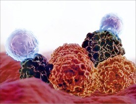 암세포(갈색)를 공격하는 TCR-T세포(보라색). NIH·카이트파마 제공
