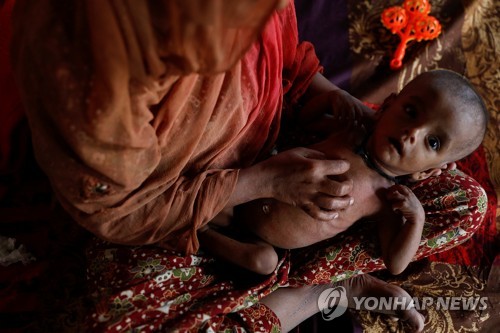 이달 7일(현지시간) 방글라데시 난민캠프에 있는 한 로힝야족 여성이 영양실조와 피부병에 걸린 7개월 된 아들을 안고 있다. [로이터=연합뉴스]