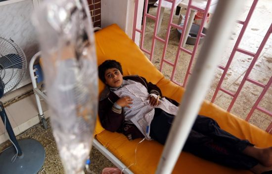 (사나<예멘> EPA=연합뉴스) 17일(현지시간) 예멘 수도 사나에서 콜레라에 감염된 한 어린이가 치료를 받고 있다. 현지 보도에 따르면 콜레라 환자는 50만명을 넘어섰으며, 4월 이후 약 2천명이 숨졌다.