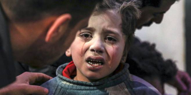 시리아 정부군이 19일(현지시간) 수도 다마스쿠스 인근 반군 거점지역 동구타의 도시 두마에 벌인 공습으로 부상한 아이가 병원에서 눈물을 흘리고 있다.  두마 | EPA연합뉴스