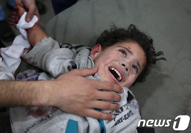 시리아 동구타에서 정부군 공격에 부상한 어린이 모하메드 말라스. © AFP=뉴스1
