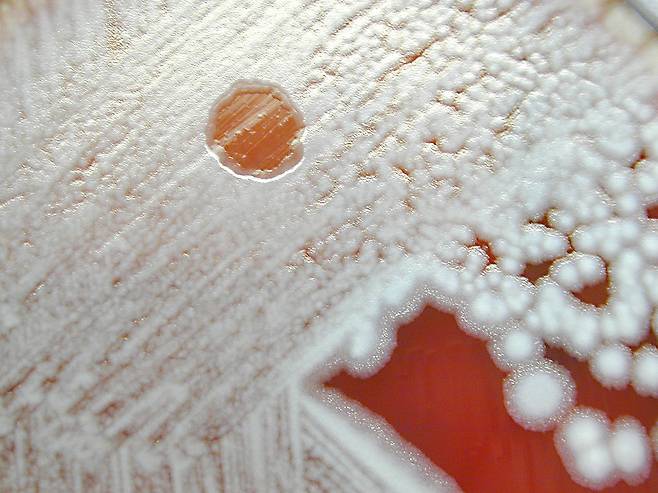 바실러스 균이 자란 배지 위에 투명한 구역(위쪽 가운데)을 만든 박테리오파지 [중앙포토]