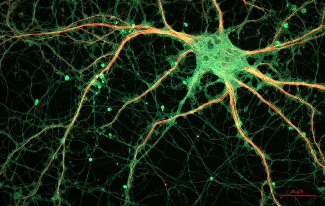 학습과 기억 중추인 해마에 있는 신경세포(뉴런). 신경세포 하나엔 다른 신경세포들과 신호를 주고받는 ‘시냅스’가 수천 개나 있어 매우 복잡한 네트워크를 이루고 있다. 위키미디어 코먼스 제공