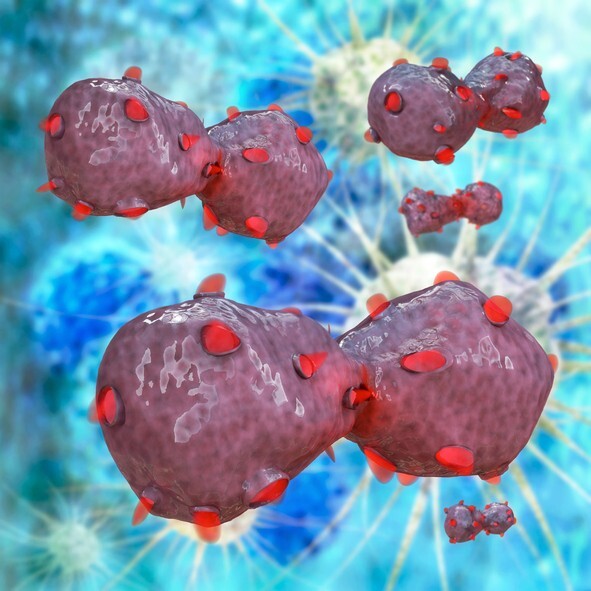 폐 종양의 상상도로 종양 표면에 단백질(빨간색)이 박혀있는 모습- GIB 제공
