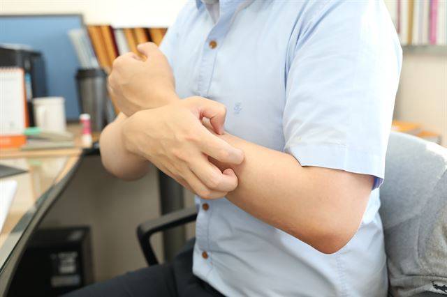 모기에 물린 자국을 함부로 긁다가 덧나 자칫 봉와직염에 걸릴 수 있다. 고려대안산병원 제공
