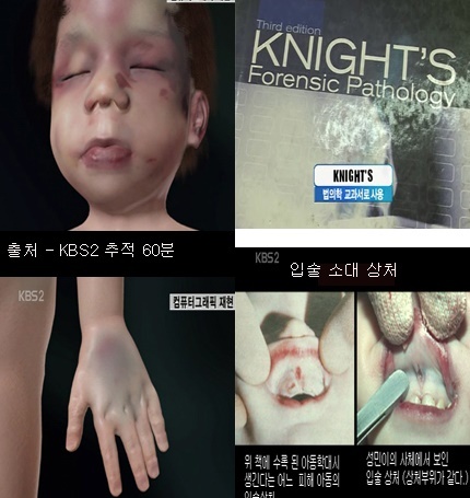사진= '성민이 사건'을 보도한 KBS '추적 60분' 방송화면 캡처