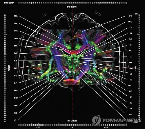 세계 최초로 제작된 '뇌 신경 지도' [가천대 뇌과학연구소 제공]