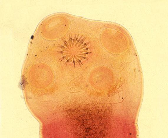 유구조충 머리(scolex)의 모습. 흡반 4개와 한가운데에 27~28개의 갈고리가 보인다. 출처=Korean J Parasitol