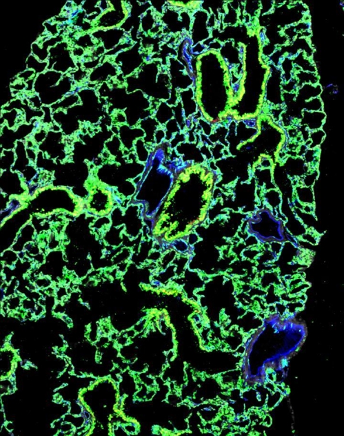줄기세포가 이식된 생쥐의 폐(전자현미경 이미지) [컬럼비아대 어빙 메디컬 센터 제공]
