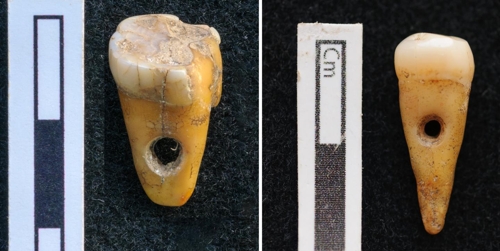 사람 이빨에 구멍을 뚫은 8천500년 전 장신구 [코펜하겐 대학 제공]