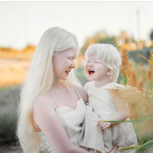 백색증을 앓고 있는 카자흐스탄의 모델 아셀 칼라가노바(왼쪽)가 동생 카밀라를 안고 환하게 웃고 있다.