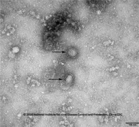 신종 코로나바이러스 전자현미경 사진/사진=질병관리본부
